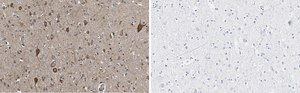 Anti-VGLUT2 Antibody, clone 8G9.2 ZooMAb&#174; Mouse Monoclonal recombinant, expressed in HEK 293 cells