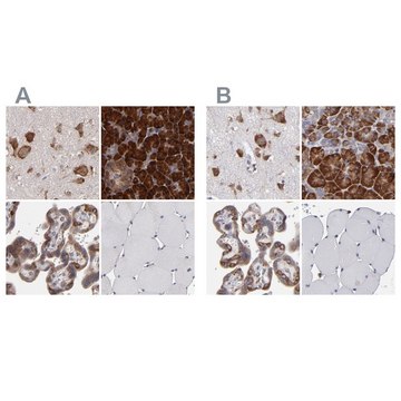 Anti-SND1 antibody produced in rabbit Prestige Antibodies&#174; Powered by Atlas Antibodies, affinity isolated antibody, buffered aqueous glycerol solution