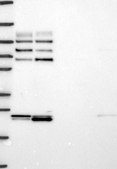 Anti-GAB1 antibody produced in rabbit Prestige Antibodies&#174; Powered by Atlas Antibodies, affinity isolated antibody, buffered aqueous glycerol solution