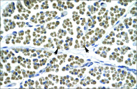 Anti-GABRD antibody produced in rabbit affinity isolated antibody