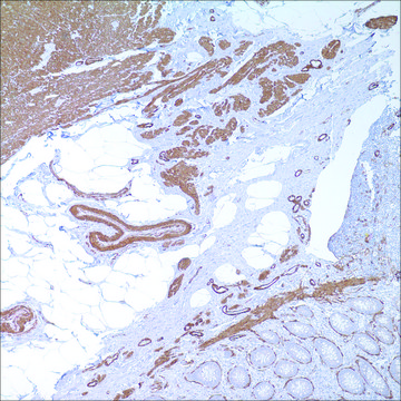 Actin, Smooth Muscle (1A4) Mouse Monoclonal Antibody