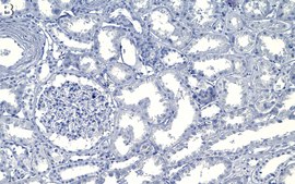 Anti-N-WASP Antibody, clone 1D16 ZooMAb&#174; Rabbit Monoclonal recombinant, expressed in HEK 293 cells