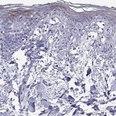 Anti-CCL27 Prestige Antibodies&#174; Powered by Atlas Antibodies, affinity isolated antibody