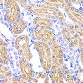 Anti-ALDH2 antibody produced in rabbit