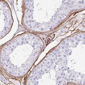 Anti-CD34 antibody produced in rabbit Prestige Antibodies&#174; Powered by Atlas Antibodies, affinity isolated antibody, buffered aqueous glycerol solution