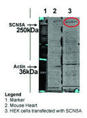Anti-SCN5A (C-terminal) antibody produced in rabbit affinity isolated antibody