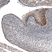 Anti-IRX1 antibody produced in rabbit Prestige Antibodies&#174; Powered by Atlas Antibodies, affinity isolated antibody, buffered aqueous glycerol solution