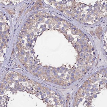 Anti-USPL1 antibody produced in rabbit Prestige Antibodies&#174; Powered by Atlas Antibodies, affinity isolated antibody, buffered aqueous glycerol solution