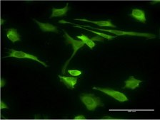 Monoclonal Anti-STIP1 antibody produced in mouse clone 2E11, purified immunoglobulin, buffered aqueous solution