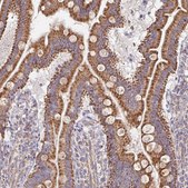 Anti-MAVS antibody produced in rabbit Prestige Antibodies&#174; Powered by Atlas Antibodies, affinity isolated antibody, buffered aqueous glycerol solution