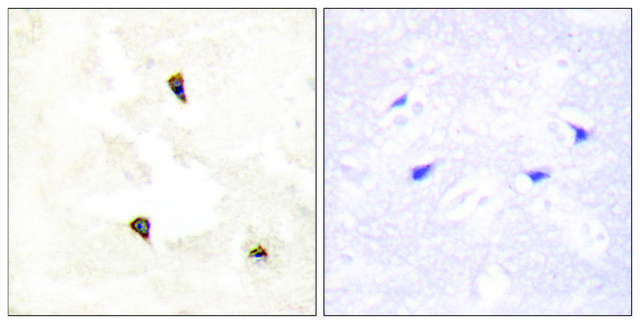 Anti-TP53I11 antibody produced in rabbit affinity isolated antibody