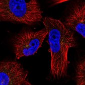Anti-PRKAR2A antibody produced in rabbit Prestige Antibodies&#174; Powered by Atlas Antibodies, affinity isolated antibody, buffered aqueous glycerol solution
