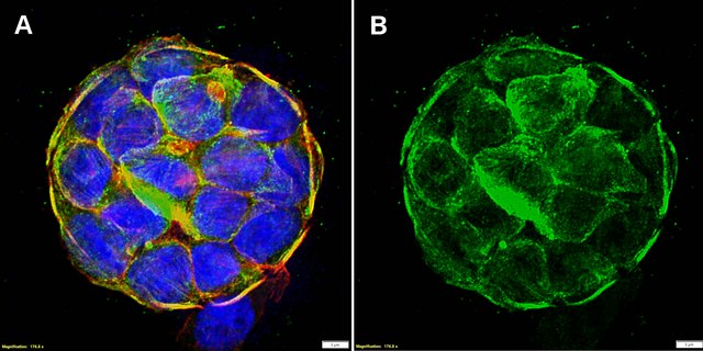 Anti-MYH14/Myosin-14 Antibody, clone 2B4 ZooMAb&#174; Rabbit Monoclonal recombinant, expressed in HEK 293 cells
