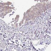 Anti-VPS4B antibody produced in rabbit Prestige Antibodies&#174; Powered by Atlas Antibodies, affinity isolated antibody, buffered aqueous glycerol solution