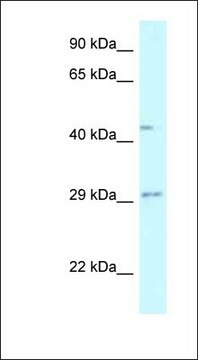 Anti-FUT8 antibody produced in rabbit affinity isolated antibody