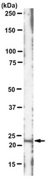 Anti-c-K-Ras Antibody, clone 234-4.2 clone 234-4.2, from mouse