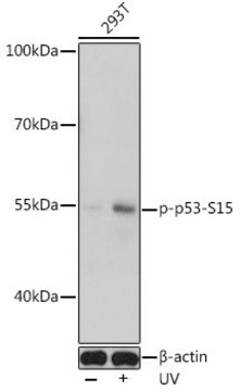 Anti-Phospho-TP53-S15 antibody produced in rabbit