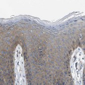 Anti-EMP2 antibody produced in rabbit Prestige Antibodies&#174; Powered by Atlas Antibodies, affinity isolated antibody, buffered aqueous glycerol solution