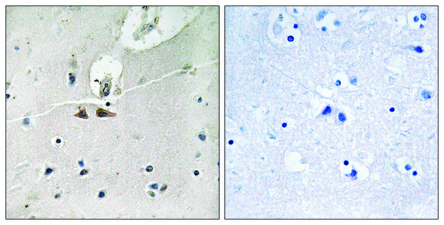 Anti-phospho-Ephrin B1/B2/B3 (pTyr324) antibody produced in rabbit affinity isolated antibody