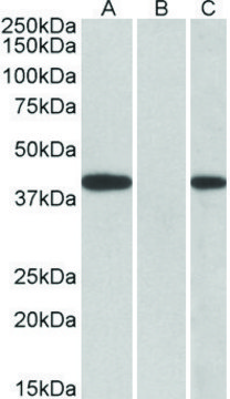 Anti-FANCF (C-terminal) antibody produced in goat affinity isolated antibody, buffered aqueous solution