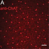 Anti-Choline Acetyltransferase Antibody Chemicon&#174;, from goat