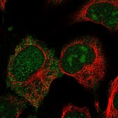 Anti-CRIP2 antibody produced in rabbit Prestige Antibodies&#174; Powered by Atlas Antibodies, affinity isolated antibody, buffered aqueous glycerol solution