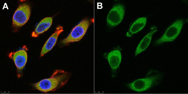 Anti-BACE1 Antibody, clone 3D5