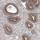 Anti-LZTR1 antibody produced in rabbit Prestige Antibodies&#174; Powered by Atlas Antibodies, affinity isolated antibody, buffered aqueous glycerol solution