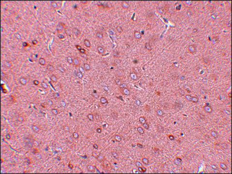 Anti-GOLPH2 antibody produced in rabbit affinity isolated antibody, buffered aqueous solution