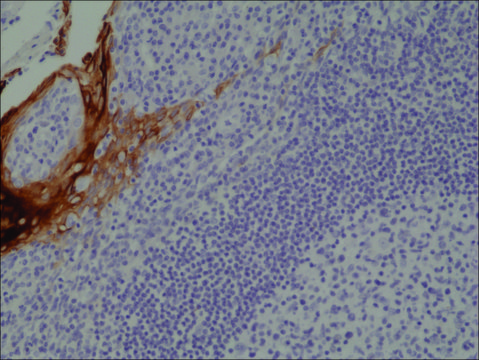Anti-Cytokeratin 4 (CK-4) antibody, Rabbit monoclonal recombinant, expressed in HEK 293 cells, clone RM355, purified immunoglobulin