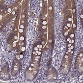Anti-ACOT11 antibody produced in rabbit Prestige Antibodies&#174; Powered by Atlas Antibodies, affinity isolated antibody