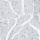 Anti-CLDN7 antibody produced in rabbit Prestige Antibodies&#174; Powered by Atlas Antibodies, affinity isolated antibody, buffered aqueous glycerol solution
