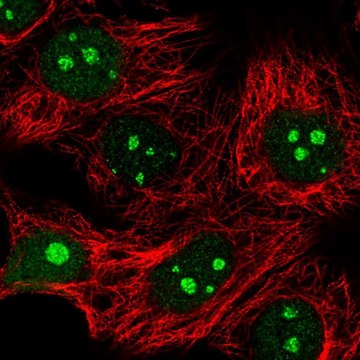 Anti-IMP4 antibody produced in rabbit Prestige Antibodies&#174; Powered by Atlas Antibodies, affinity isolated antibody