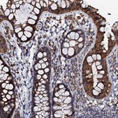 Anti-NDUFA12 antibody produced in rabbit Prestige Antibodies&#174; Powered by Atlas Antibodies, affinity isolated antibody, buffered aqueous glycerol solution