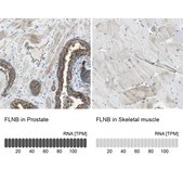 Anti-FLNB antibody produced in rabbit Prestige Antibodies&#174; Powered by Atlas Antibodies, affinity isolated antibody, buffered aqueous glycerol solution