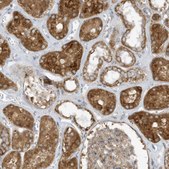 Anti-SLC38A2 antibody produced in rabbit Prestige Antibodies&#174; Powered by Atlas Antibodies, affinity isolated antibody, buffered aqueous glycerol solution
