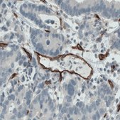 Monoclonal Anti-ENG antibody produced in mouse Prestige Antibodies&#174; Powered by Atlas Antibodies, clone CL1912, purified immunoglobulin, buffered aqueous glycerol solution