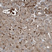 Anti-C9 antibody produced in rabbit Prestige Antibodies&#174; Powered by Atlas Antibodies, affinity isolated antibody, buffered aqueous glycerol solution