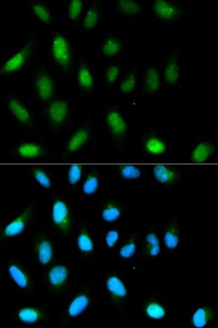 Anti- HP1 alpha/CBX5 antibody produced in rabbit