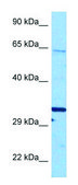 Anti-CRY1 (N-terminal) antibody produced in rabbit affinity isolated antibody