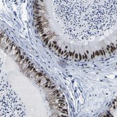 Anti-CUL4B antibody produced in rabbit Prestige Antibodies&#174; Powered by Atlas Antibodies, affinity isolated antibody, buffered aqueous glycerol solution