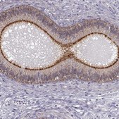 Anti-ZNF185 antibody produced in rabbit Ab1, Prestige Antibodies&#174; Powered by Atlas Antibodies, affinity isolated antibody, buffered aqueous glycerol solution
