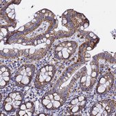 Anti-PHB2 antibody produced in rabbit Prestige Antibodies&#174; Powered by Atlas Antibodies, affinity isolated antibody, buffered aqueous glycerol solution