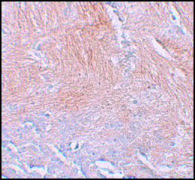 Anti-CXXC5 antibody produced in rabbit affinity isolated antibody, buffered aqueous solution