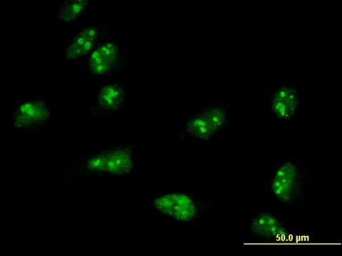 Monoclonal Anti-TASP1 antibody produced in mouse clone 3E10, purified immunoglobulin, buffered aqueous solution
