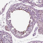 Anti-DNAH10 antibody produced in rabbit Prestige Antibodies&#174; Powered by Atlas Antibodies, affinity isolated antibody, buffered aqueous glycerol solution