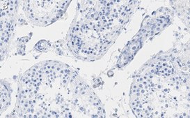 Anti-HSP90 alpha Antibody, clone 4M13 ZooMAb&#174; Rabbit Monoclonal recombinant, expressed in HEK 293 cells