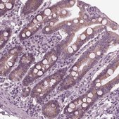 Anti-CELSR3 antibody produced in rabbit Prestige Antibodies&#174; Powered by Atlas Antibodies, affinity isolated antibody, buffered aqueous glycerol solution