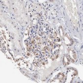 Anti-INF2 antibody produced in rabbit Prestige Antibodies&#174; Powered by Atlas Antibodies, affinity isolated antibody, buffered aqueous glycerol solution