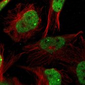 Anti-ZBTB20 antibody produced in rabbit Prestige Antibodies&#174; Powered by Atlas Antibodies, affinity isolated antibody, buffered aqueous glycerol solution